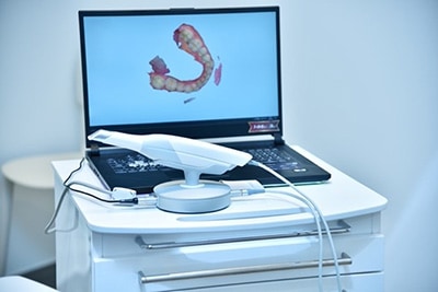 Digital Intraoral Scanner Huntersville