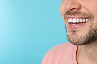 Mouth Restoration Huntersville