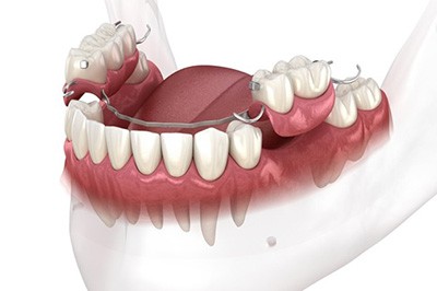 Dentures Huntersville