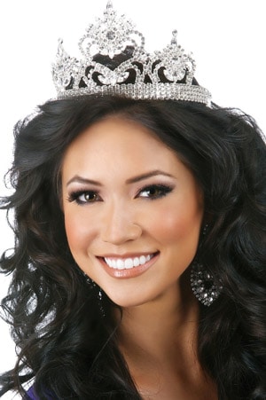 1 Tooth Colored Fillings in Charlotte & Huntersville, NC