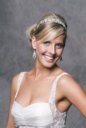 DTS_3539 Inlays & Onlays in Charlotte & Huntersville, NC