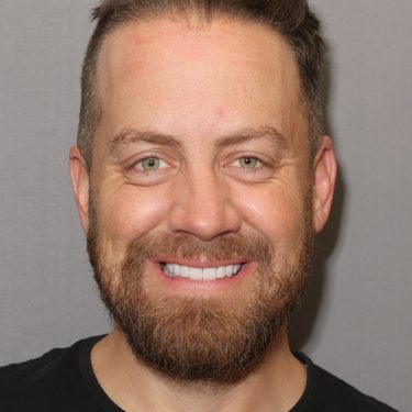 IMG_2155-375x375 Smile Makeover in Charlotte & Huntersville, NC