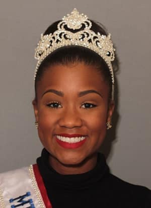 Mrs-NC-Nina-Johnson2 Smile Makeover in Charlotte & Huntersville, NC