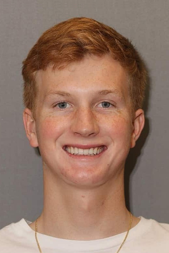 After Image: Dental Bonding - front