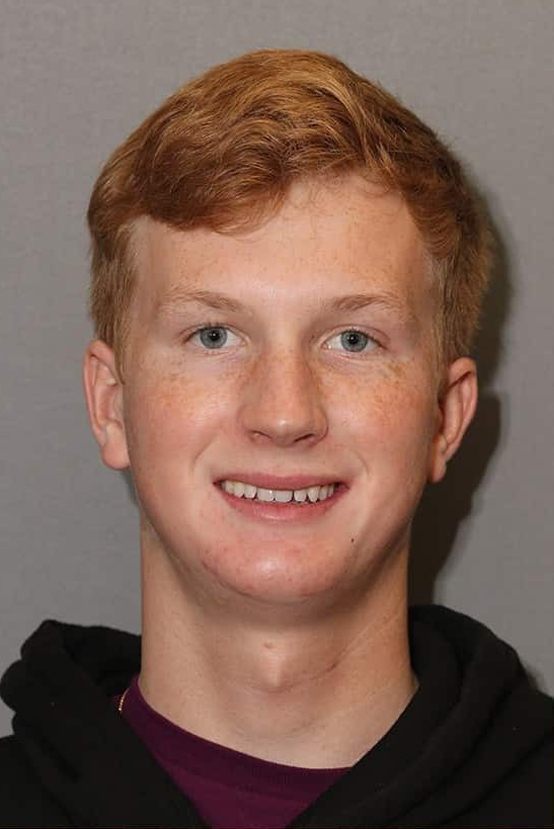 Before Image: Dental Bonding - front