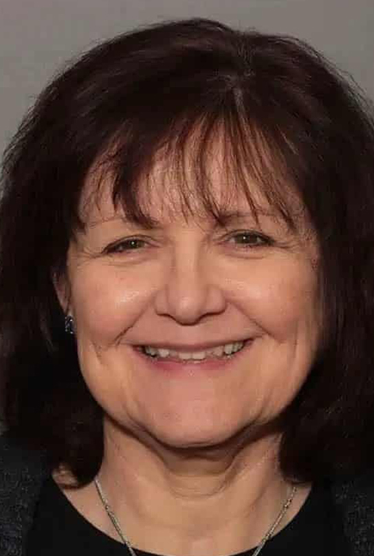 Before Image: Full Mouth Makeover - front