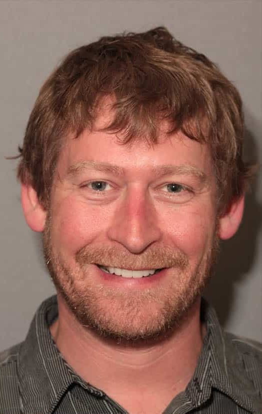 After Image: Implants & Crowns - front