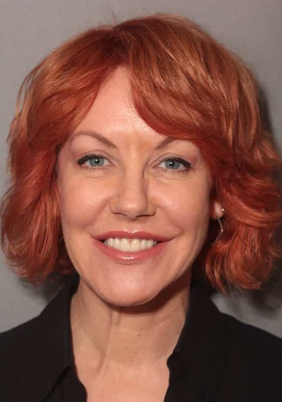 Before Image: Porcelain Crowns - front