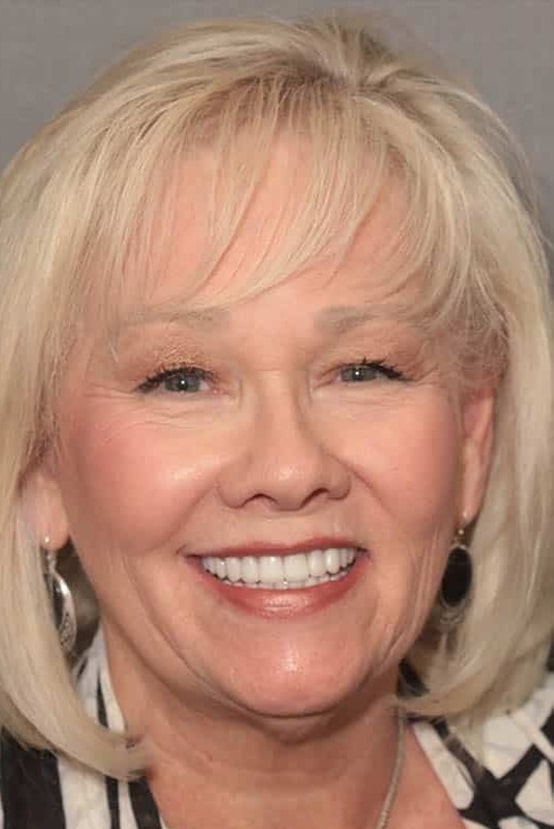 After Image: Porcelain Crowns - front