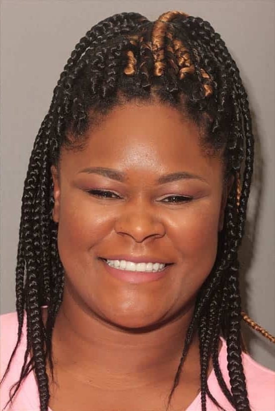 After Image: Porcelain Veneers - front