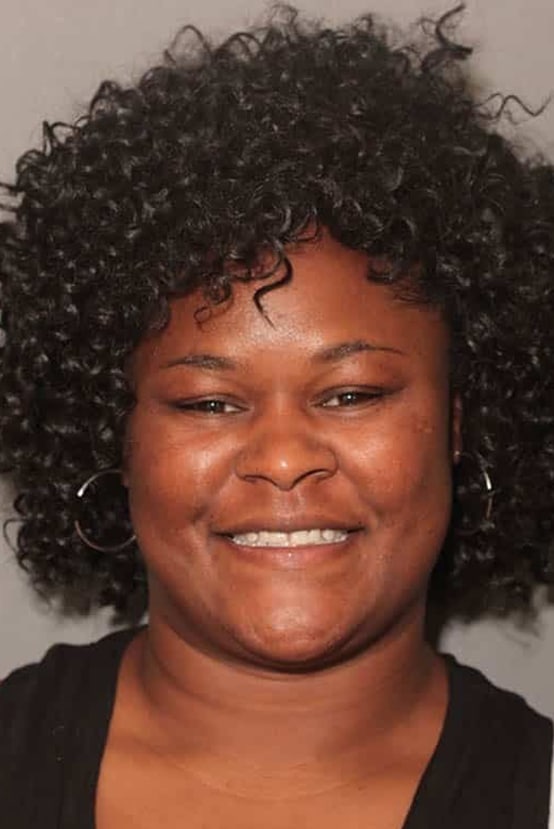 Before Image: Porcelain Veneers - front