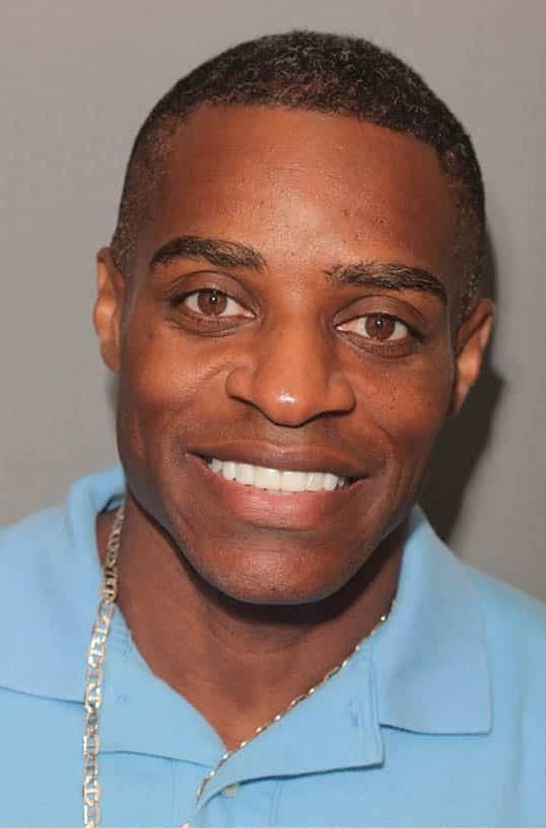 After Image: Porcelain Veneers - front