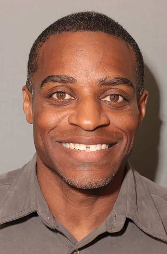 Before Image: Porcelain Veneers - front