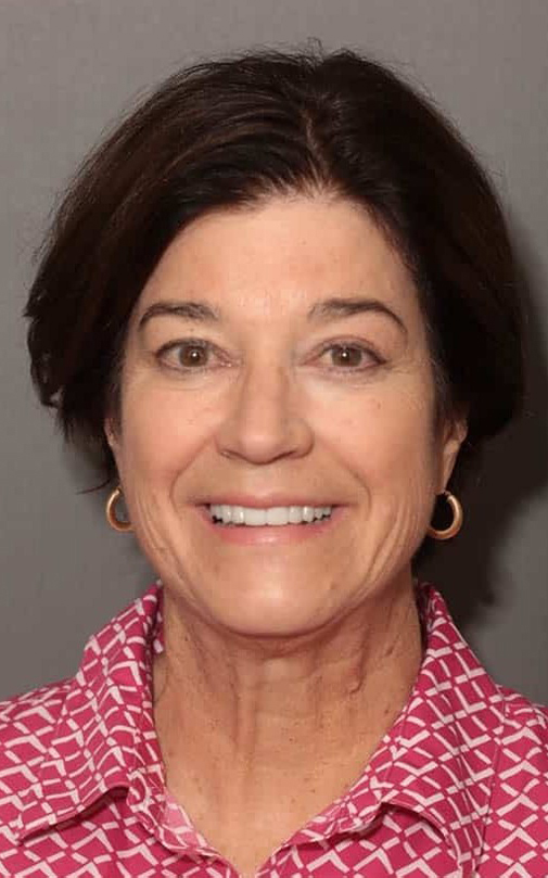 After Image: Porcelain Veneers - front