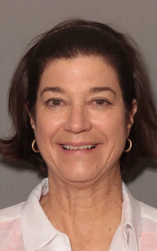 Before Image: Porcelain Veneers - front