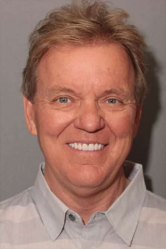 After Image: Porcelain Veneers - front