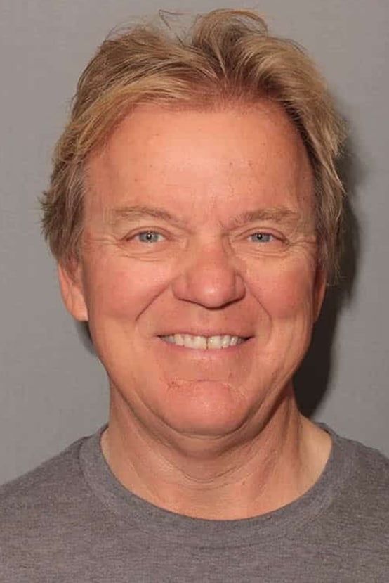 Before Image: Porcelain Veneers - front