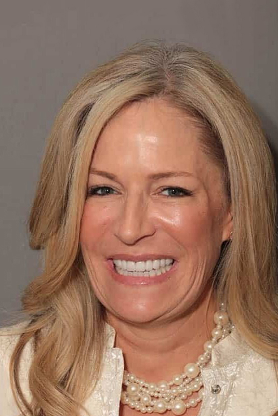 After Image: Porcelain Veneers - front