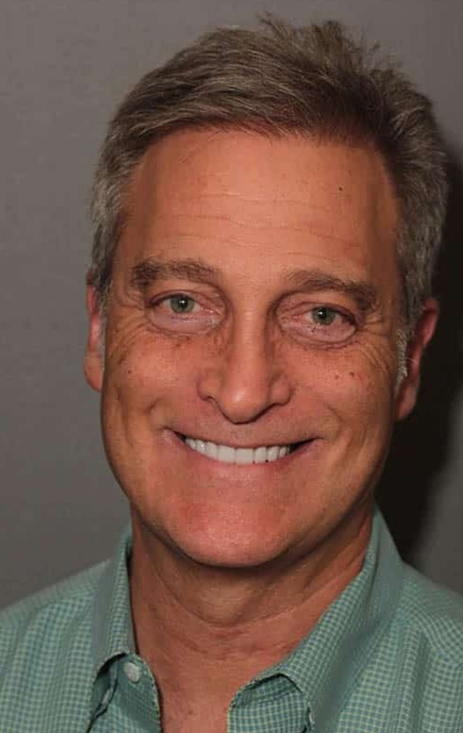 After Image: Porcelain Veneers - front