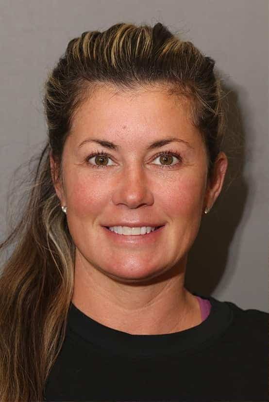 Before Image: Porcelain Veneers - front